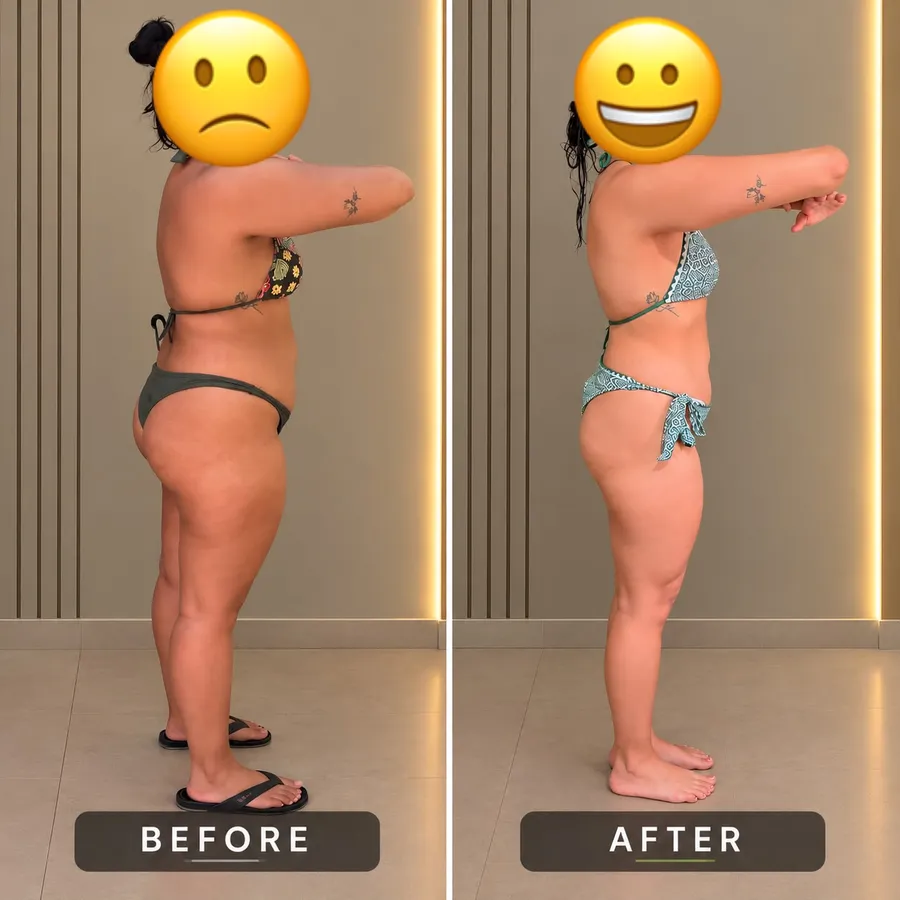 Antes e depois de uma aluna, vista de lado, na mesma pose. Rosto coberto.